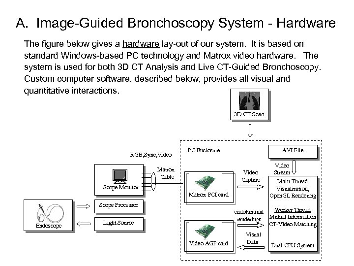 A. Image-Guided Bronchoscopy System - Hardware The figure below gives a hardware lay-out of