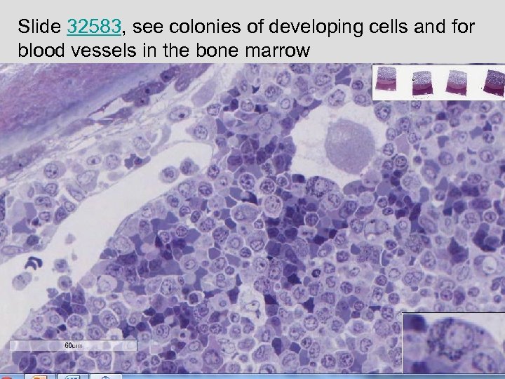 Slide 32583, see colonies of developing cells and for blood vessels in the bone