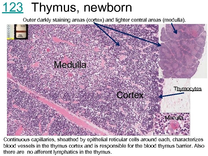 123 Thymus, newborn Outer darkly staining areas (cortex) and lighter central areas (medulla). Medulla