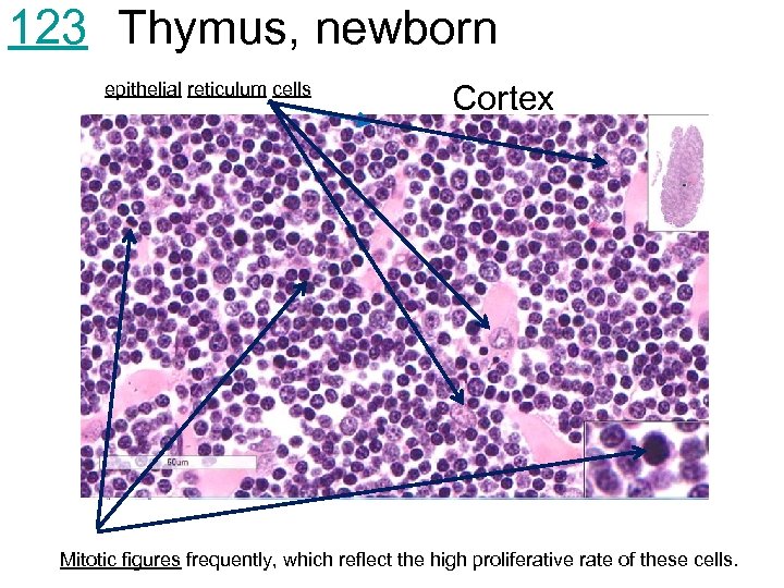 123 Thymus, newborn epithelial reticulum cells Cortex Mitotic figures frequently, which reflect the high