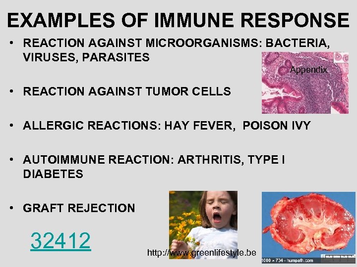 EXAMPLES OF IMMUNE RESPONSE • REACTION AGAINST MICROORGANISMS: BACTERIA, VIRUSES, PARASITES Appendix • REACTION
