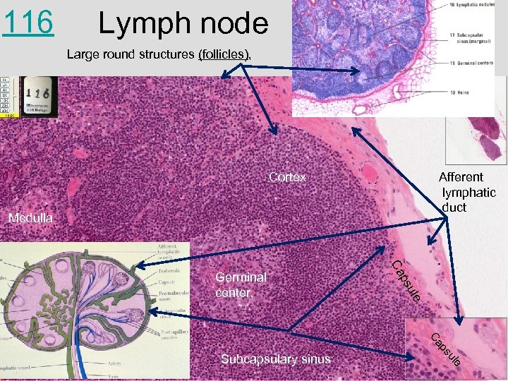 116 Lymph node Large round structures (follicles), Cortex Afferent lymphatic duct Medulla le su