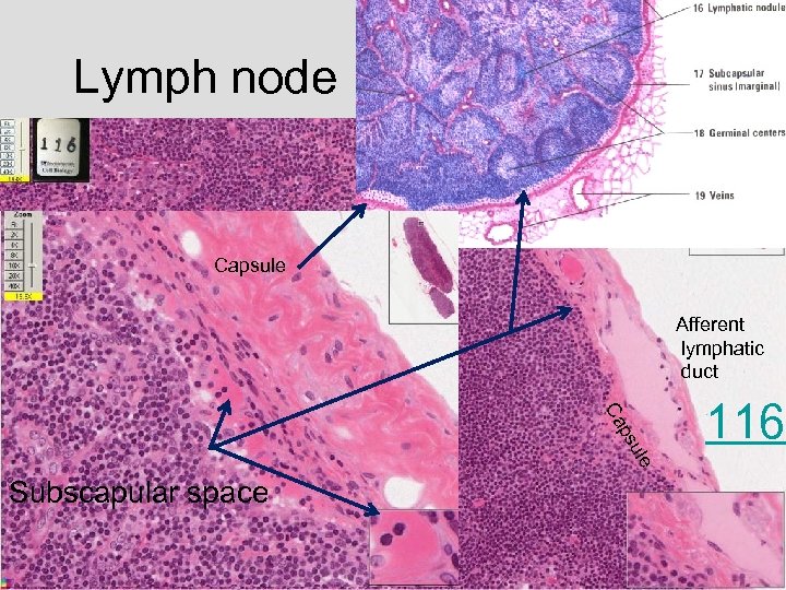 Lymph node Capsule Afferent lymphatic duct le su p Ca Subscapular space 116 