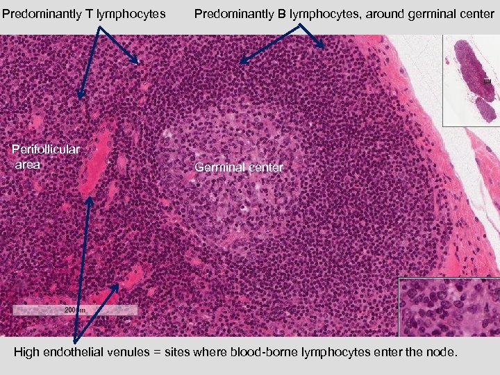 Predominantly T lymphocytes Perifollicular area Predominantly B lymphocytes, around germinal center Germinal center High