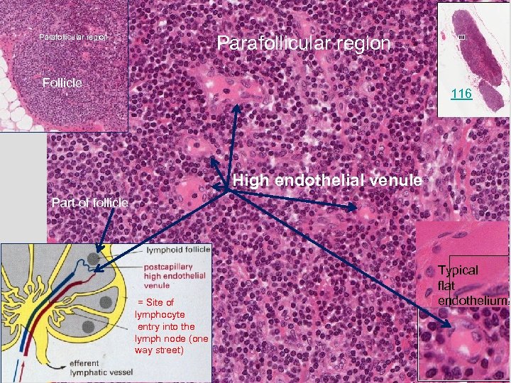 Parafollicular region Follicle 116 High endothelial venule Part of follicle = Site of lymphocyte