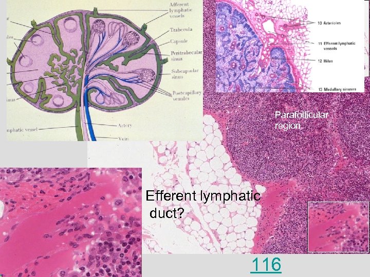 Parafollicular region Efferent lymphatic duct? 116 