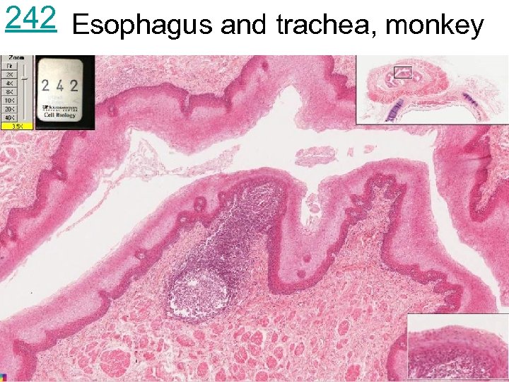 242 Esophagus and trachea, monkey 