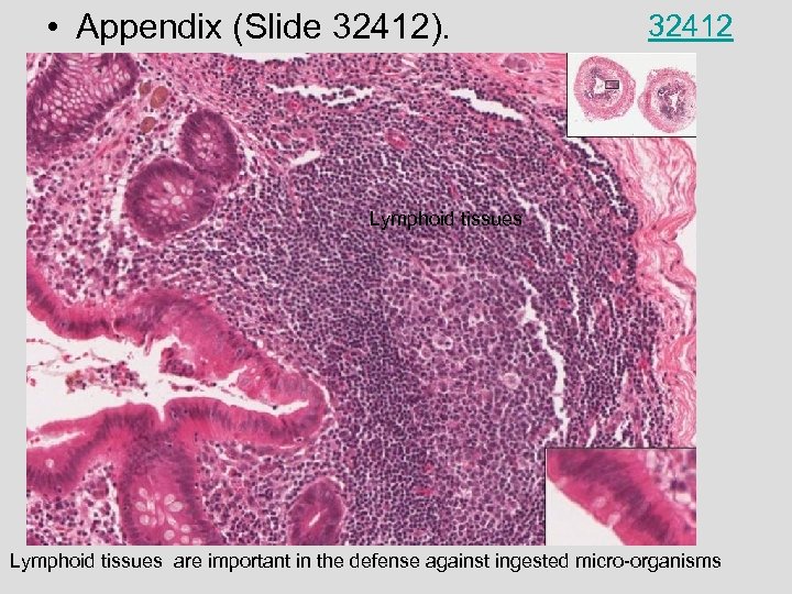  • Appendix (Slide 32412). 32412 Lymphoid tissues are important in the defense against