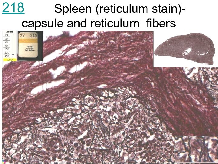 218 Spleen (reticulum stain)capsule and reticulum fibers 