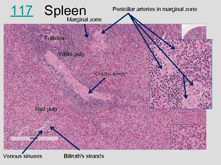 117 Spleen zone Marginal Penicillar arteries in marginal zone Follicles White pulp Central artery