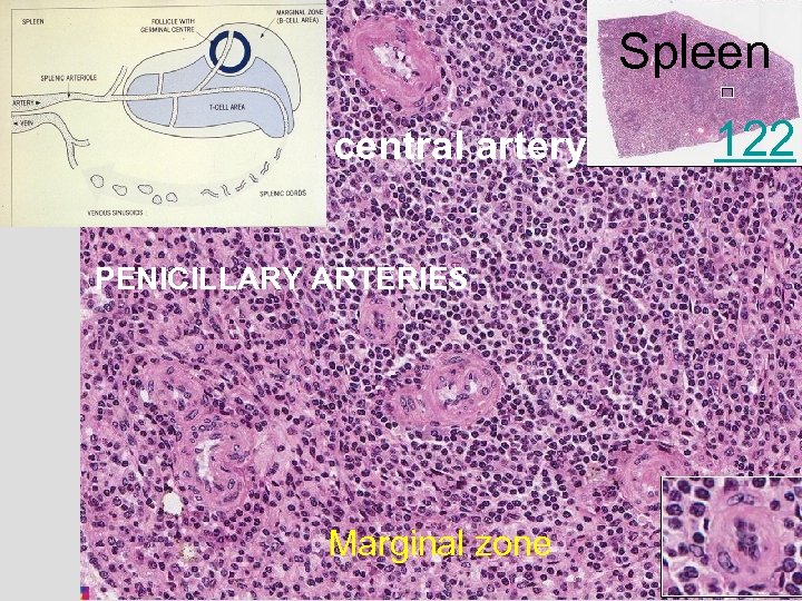 Spleen central artery PENICILLARY ARTERIES Marginal zone 122 