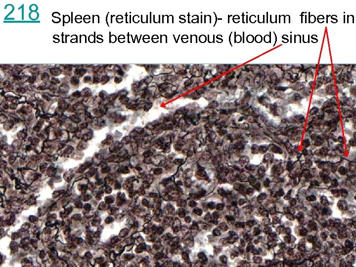 218 Spleen (reticulum stain)- reticulum fibers in strands between venous (blood) sinus 