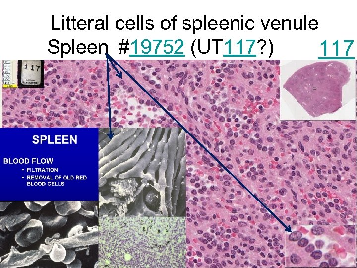 Litteral cells of spleenic venule Spleen #19752 (UT 117? ) 117 