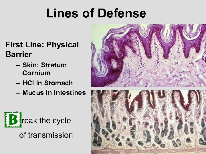 Lines of Defense First Line: Physical Barrier – Skin: Stratum Cornium – HCl In