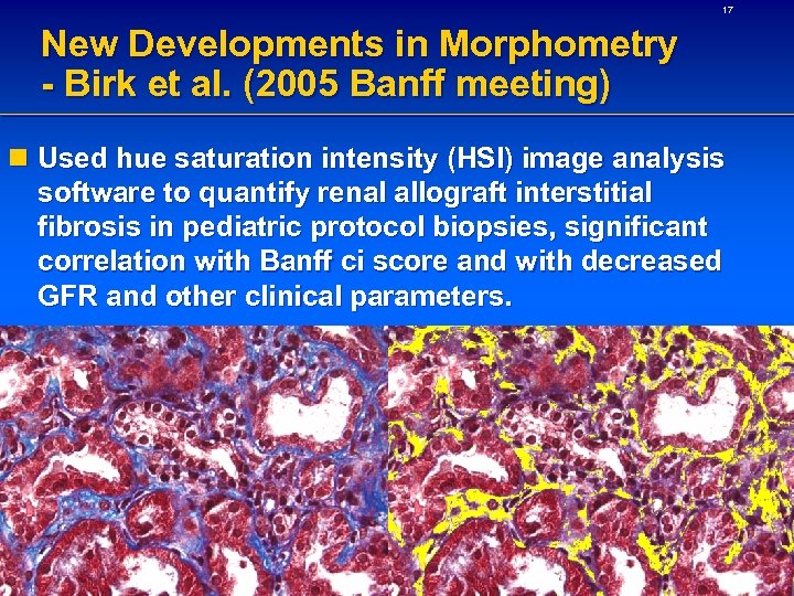 17 New Developments in Morphometry - Birk et al. (2005 Banff meeting) n Used