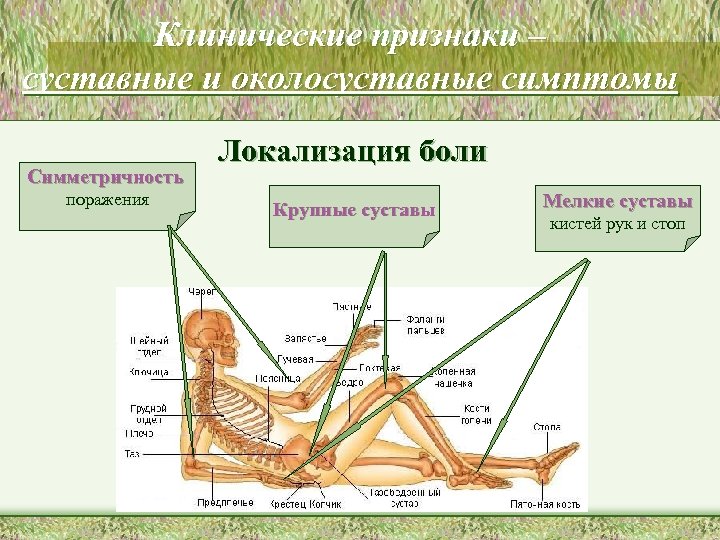 Клинические признаки – суставные и околосуставные симптомы Симметричность поражения Локализация боли Крупные суставы Мелкие