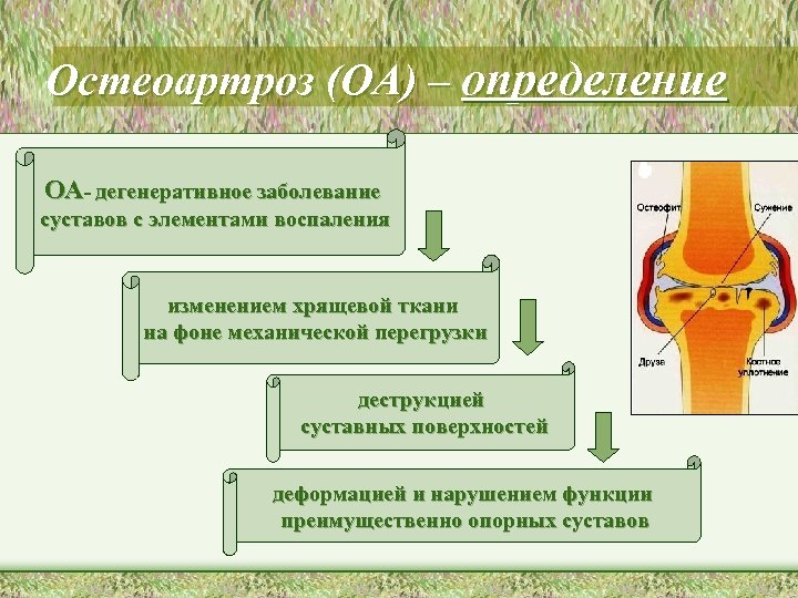 Остеоартроз (ОА) – определение ОА- дегенеративное заболевание суставов с элементами воспаления изменением хрящевой ткани