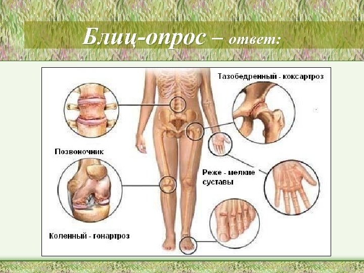 Блиц-опрос – ответ: 