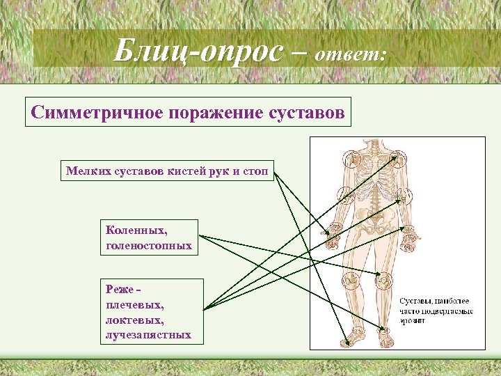 Блиц-опрос – ответ: Симметричное поражение суставов Мелких суставов кистей рук и стоп Коленных, голеностопных