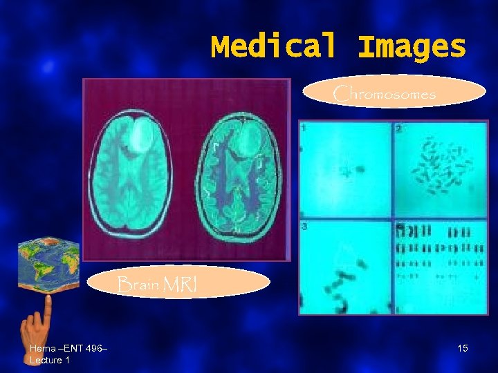 Medical Images Chromosomes Brain MRI Hema –ENT 496– Lecture 1 15 