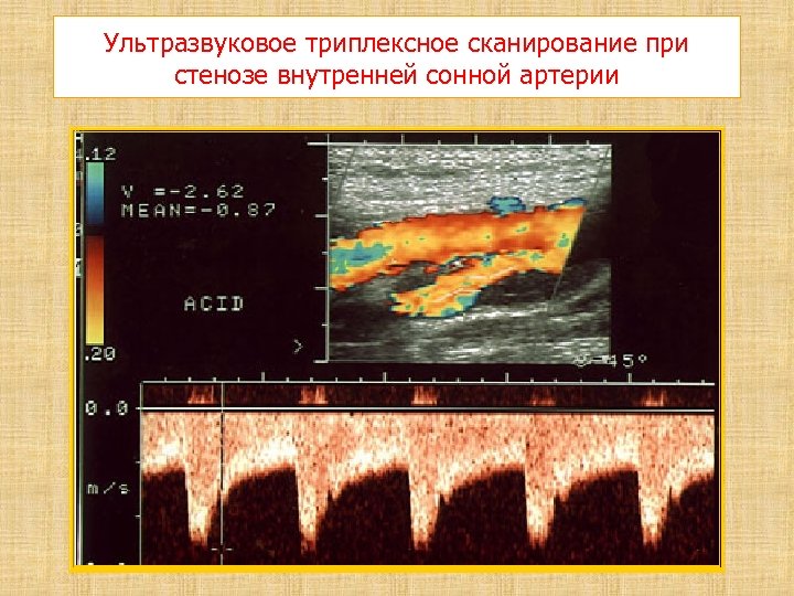 Брахиоцефальное сканирование