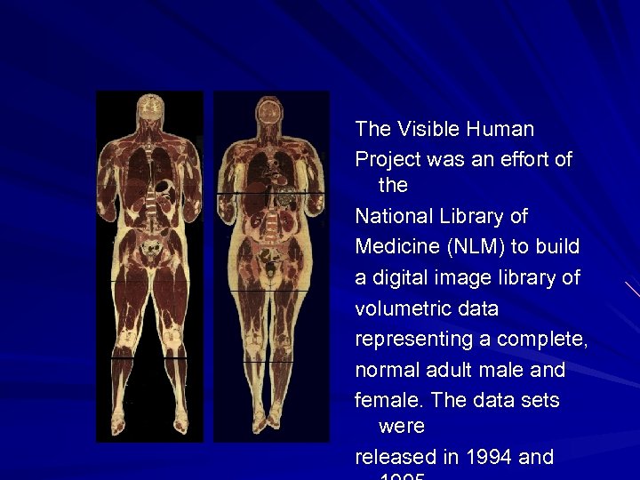 The Visible Human Project was an effort of the National Library of Medicine (NLM)