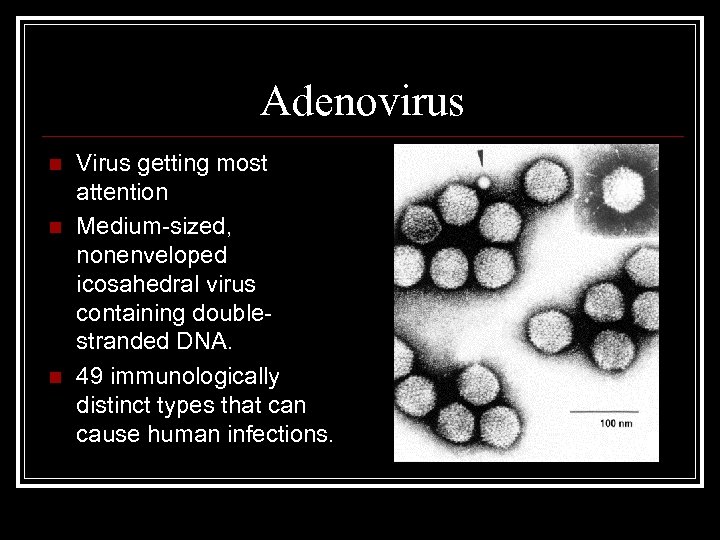 Adenovirus n n n Virus getting most attention Medium-sized, nonenveloped icosahedral virus containing doublestranded