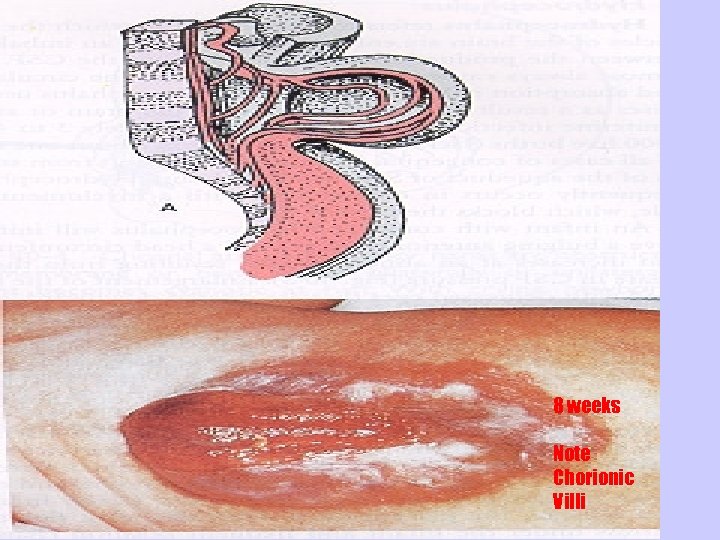 8 weeks Note Chorionic Villi 