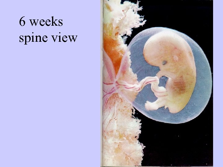 6 weeks spine view 