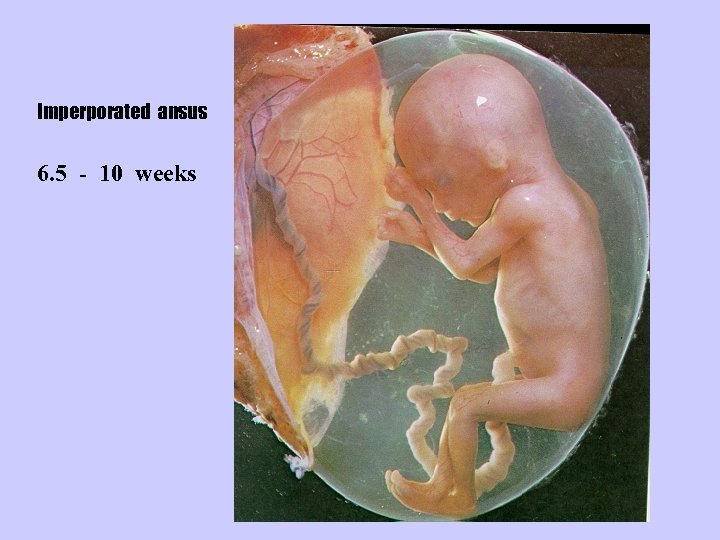 Imperporated ansus 6. 5 - 10 weeks 