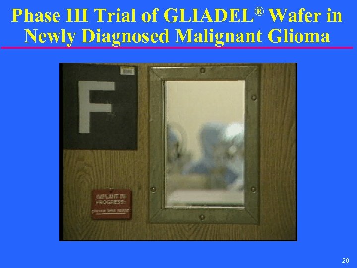 Phase III Trial of GLIADEL® Wafer in Newly Diagnosed Malignant Glioma 20 