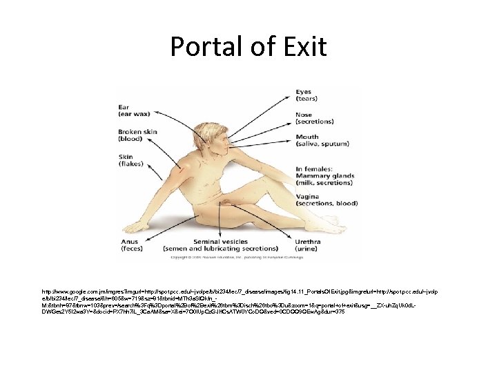 Portal of Exit http: //www. google. com. jm/imgres? imgurl=http: //spot. pcc. edu/~jvolpe/b/bi 234/lec/7_disease/images/fig 14.