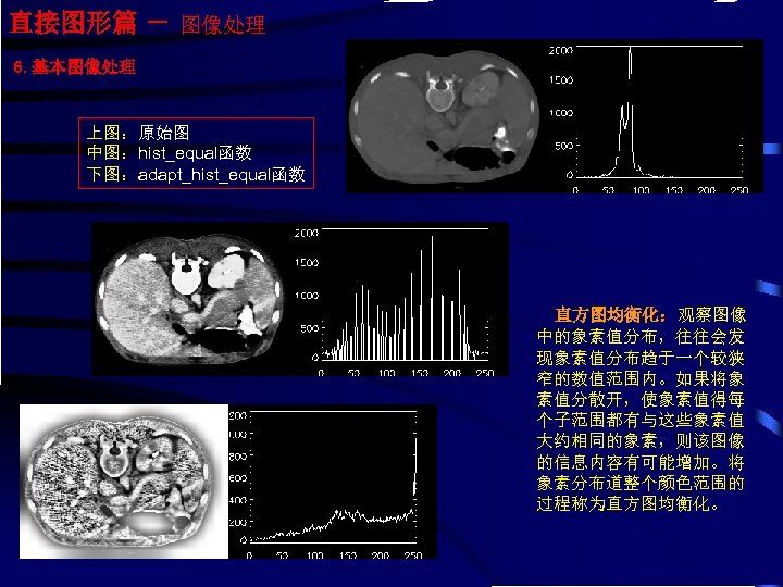 直接图形篇 － 图像处理 6. 基本图像处理 上图：原始图 中图：hist_equal函数 下图：adapt_hist_equal函数 直方图均衡化：观察图像 中的象素值分布，往往会发 现象素值分布趋于一个较狭 窄的数值范围内。如果将象 素值分散开，使象素值得每 个子范围都有与这些象素值