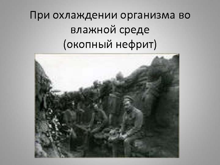 При охлаждении организма во влажной среде (окопный нефрит) 