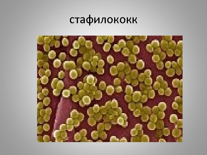 стафилококк 