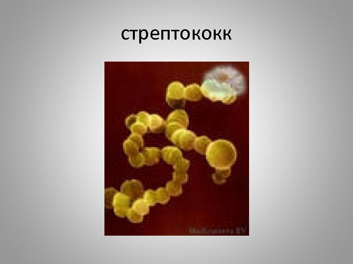 стрептококк 