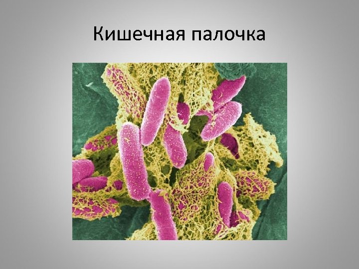 Кишечная палочка 