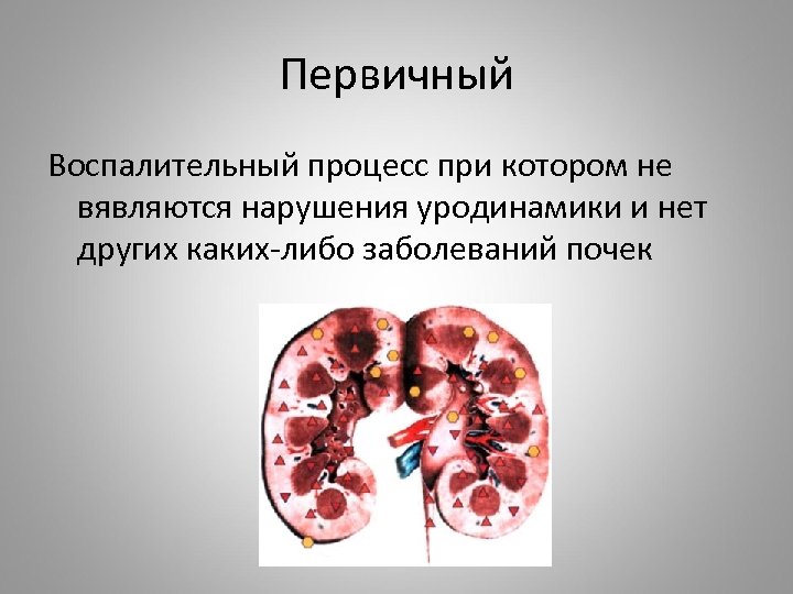 Первичный Воспалительный процесс при котором не вявляются нарушения уродинамики и нет других каких-либо заболеваний