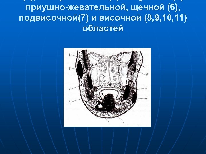 Флегмона подвисочной ямки