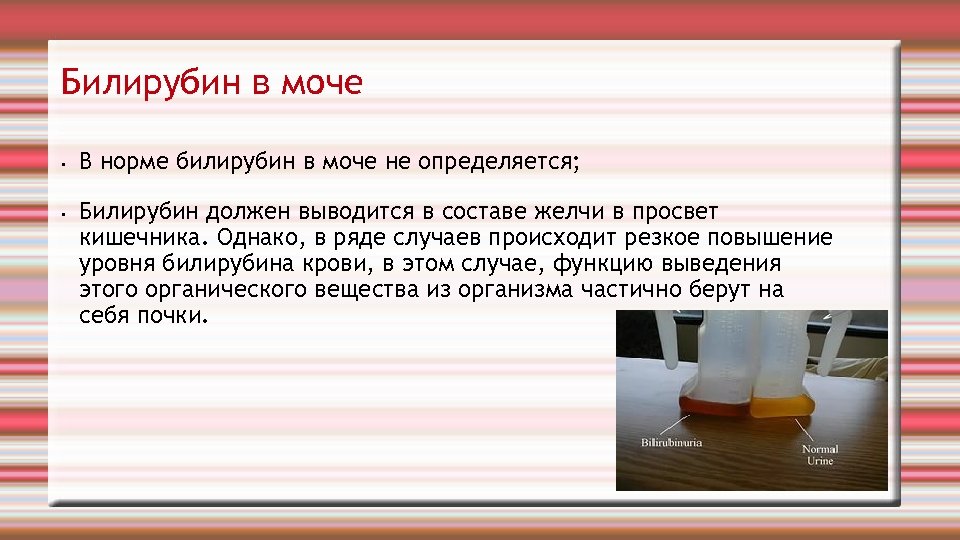 В чем может быть при. Билирубин в моче. Билирубин в моче в норме. Билирубин в моче у ребенка. В норме в моче есть билирубин.