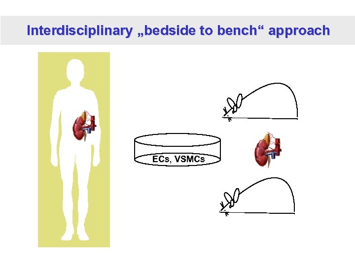 Interdisciplinary „bedside to bench“ approach ECs, VSMCs 
