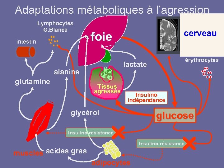 Adaptations métaboliques à l’agression Lymphocytes G. Blancs intestin érythrocytes lactate alanine glutamine cerveau foie