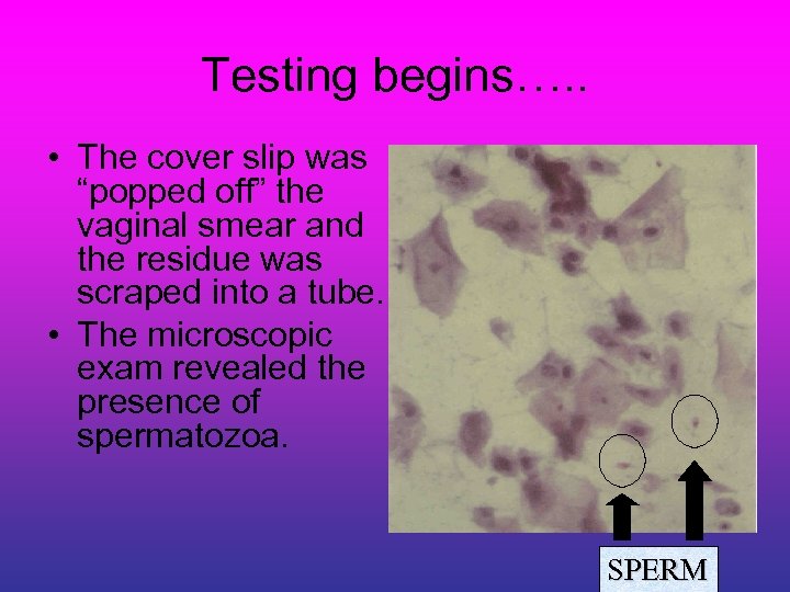 Testing begins…. . • The cover slip was “popped off” the vaginal smear and
