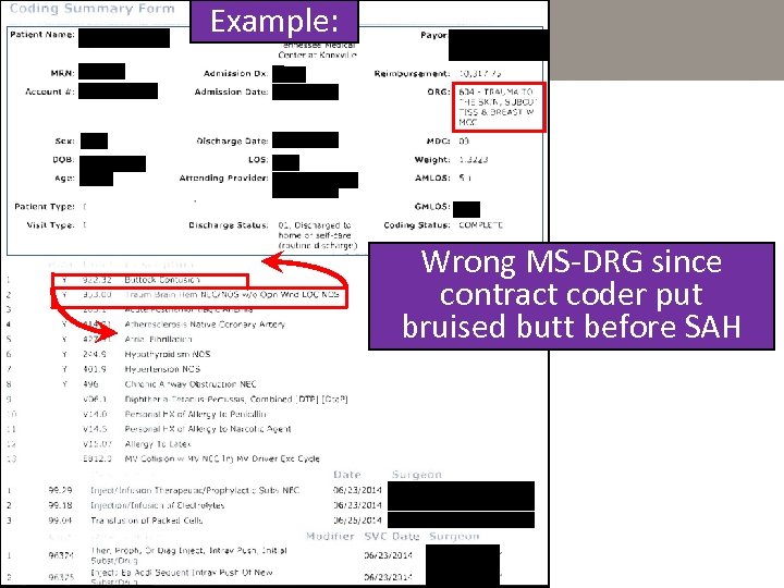 Example: Wrong MS-DRG since contract coder put bruised butt before SAH 