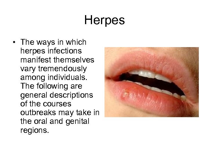 Herpes • The ways in which herpes infections manifest themselves vary tremendously among individuals.