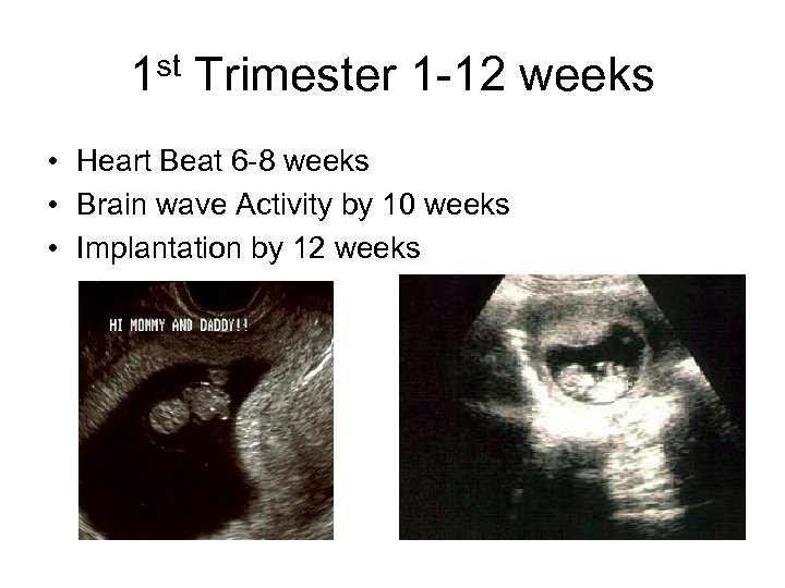 1 st Trimester 1 -12 weeks • Heart Beat 6 -8 weeks • Brain