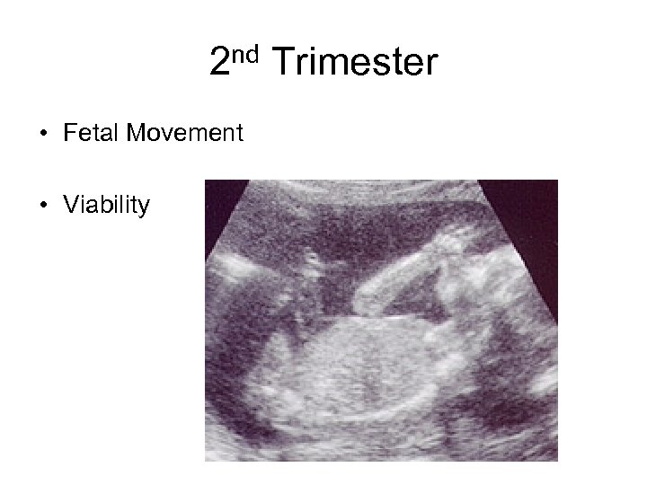 2 nd Trimester • Fetal Movement • Viability 