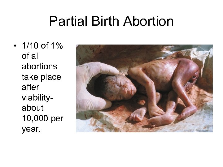 Partial Birth Abortion • 1/10 of 1% of all abortions take place after viabilityabout