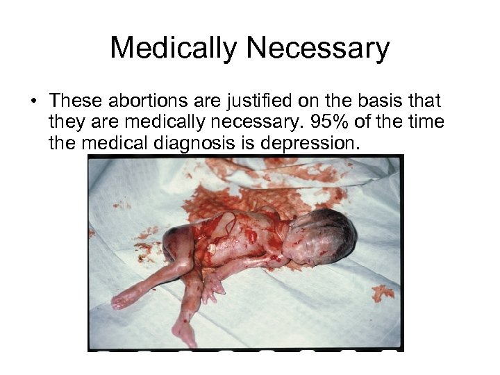 Medically Necessary • These abortions are justified on the basis that they are medically