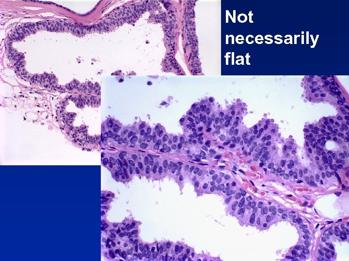 Not necessarily flat 